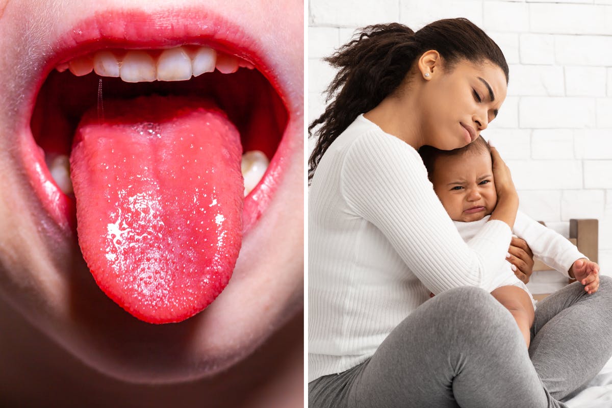 Strep A and Scarlet Fever :: Healthier Together