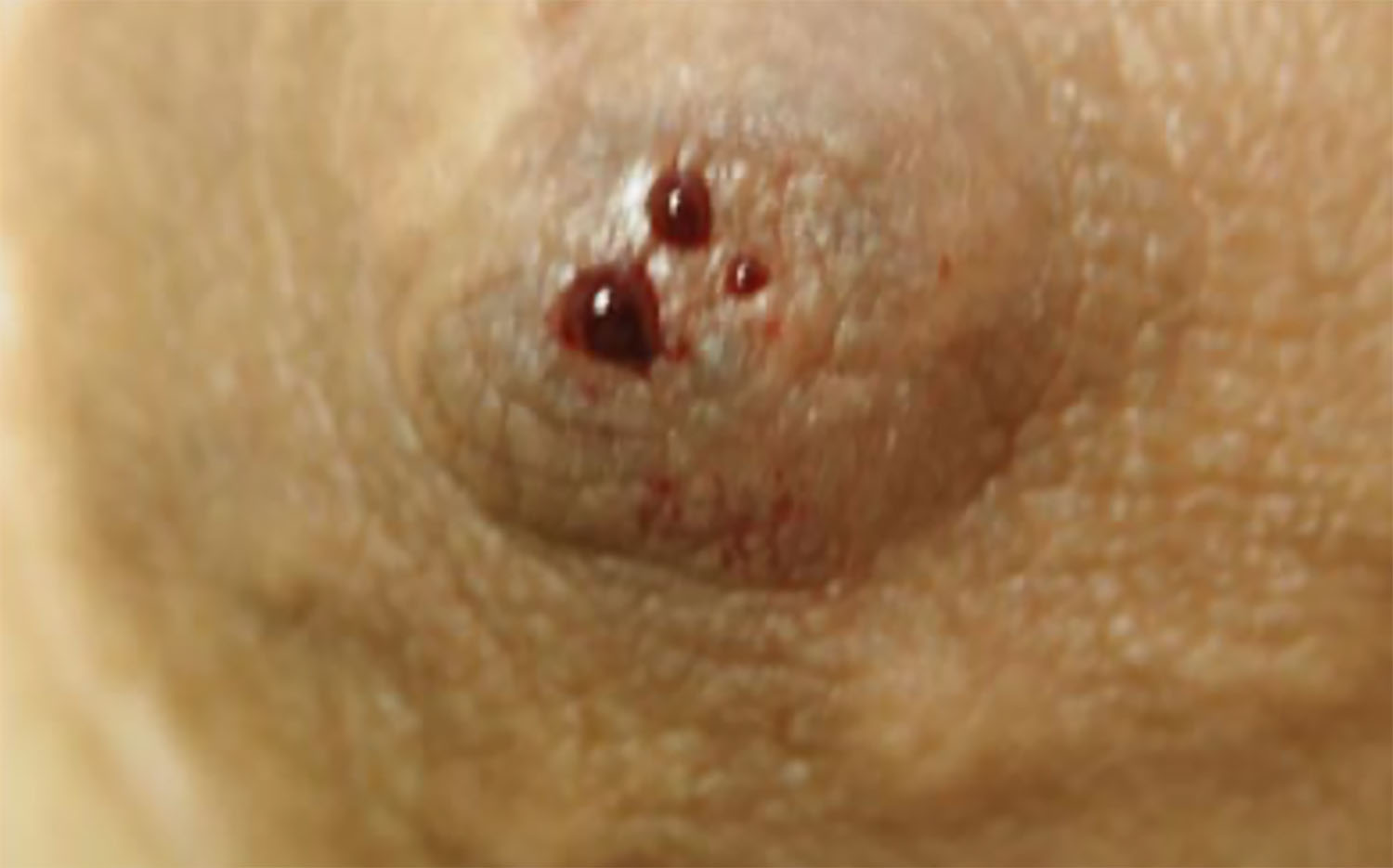 черные выделения из груди у женщин фото 6