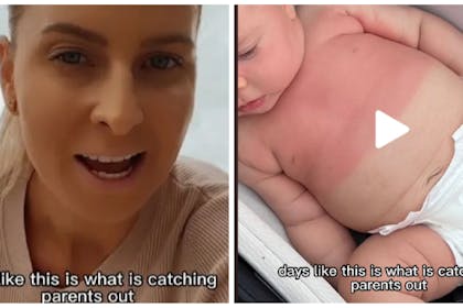 Left: TikTok woman warns of UV dangersRight: baby with sunburn