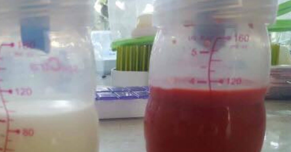 Mum Shares Photo Of Bloody Breast Milk That’s ‘Safe To Drink’ Netmums