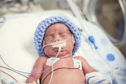 Premature baby hooked up to wire