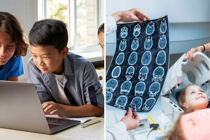 Left 3 children looking at a laptop screenRight: a girl having a brain scan, doc looking at images