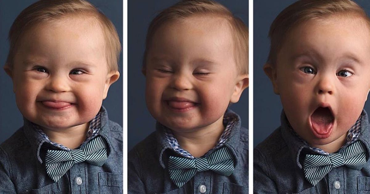 Boy With Down's Syndrome Secures Ad Campaign, After Being Rejected By Modelling  Agency - Netmums