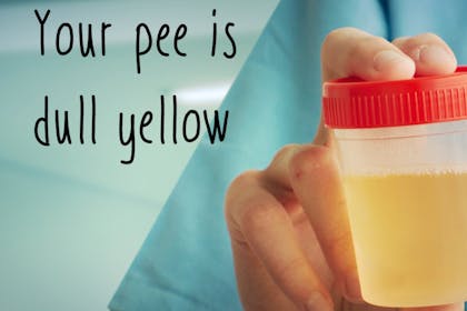doctor holding pee in cup