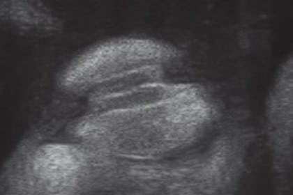 36 weeks pregnant scan
