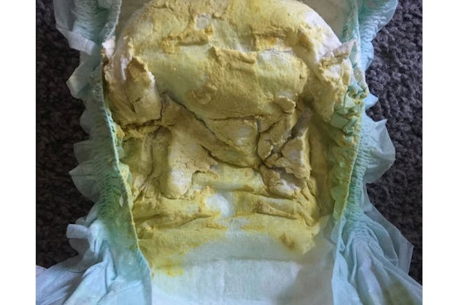 Baby Poo Photos See What S Normal And What S Not Netmums Baby Poo Photos See What S Normal And What S Not Netmums