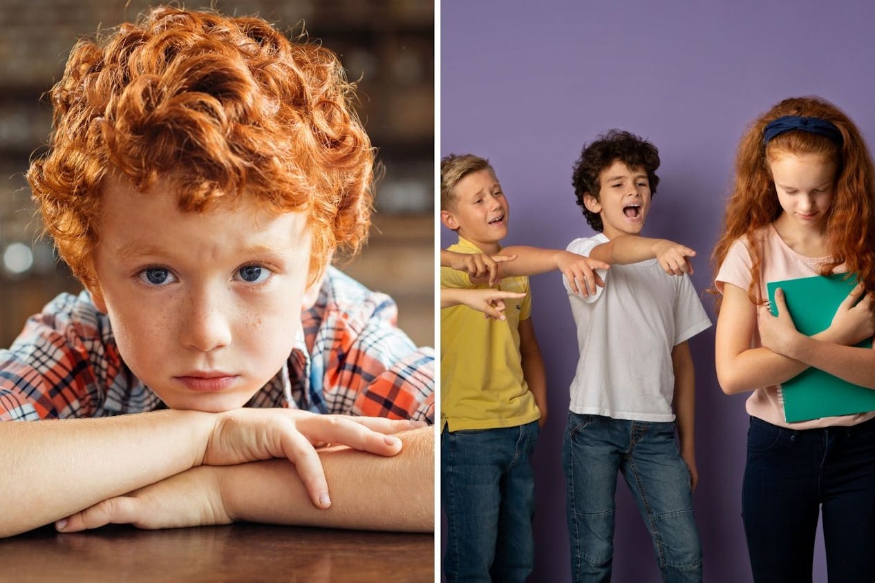 Red-head boy bullied at school for being ginger becomes MODEL and