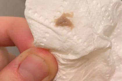 Brown Discharge before Period Could I Be Pregnant