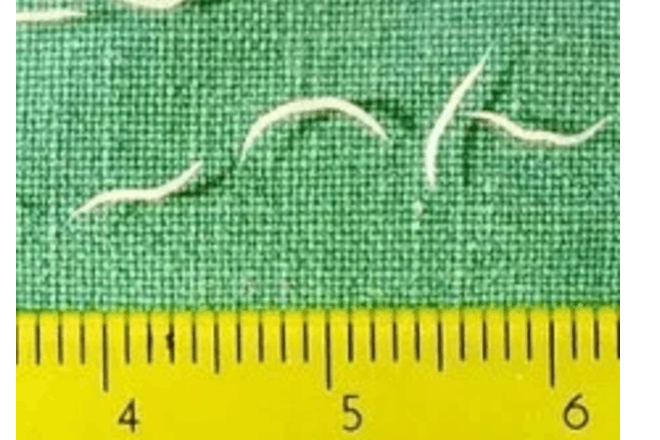 Threadworms with ruler for size comparison