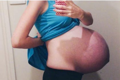 Huge Pregnant Morph Sex - Stolen bump photo appears on pregnancy fetish site - Netmums