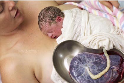 mother and newborn baby with placenta