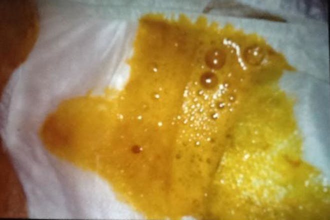 Baby Poo Photos See What S Normal And What S Not Netmums Baby Poo Photos See What S Normal And What S Not Netmums