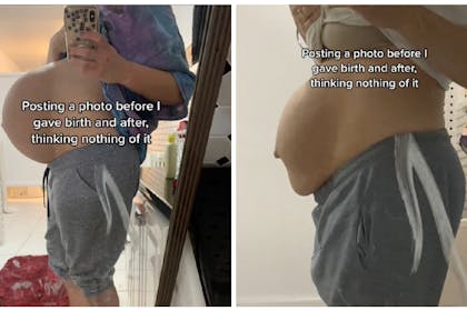 Pregnancy body / postpartum body