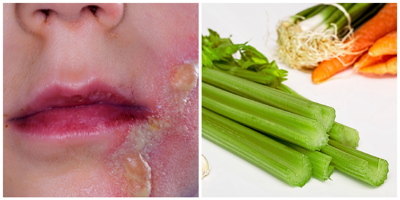 Mum's urgent ‘margarita burn’ warning after baby daughter was left