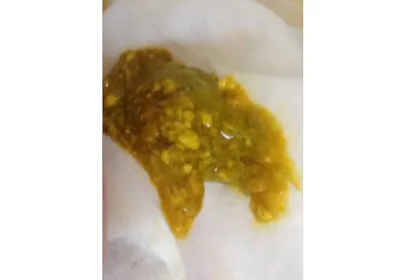 Baby Poo Photos: See What's Normal And What's Not - Netmums