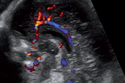 27 weeks pregnant scan
