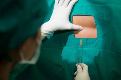 Woman getting an epidural for labour