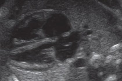 39 weeks pregnant scan