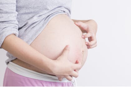 pregnant woman scratching her bump