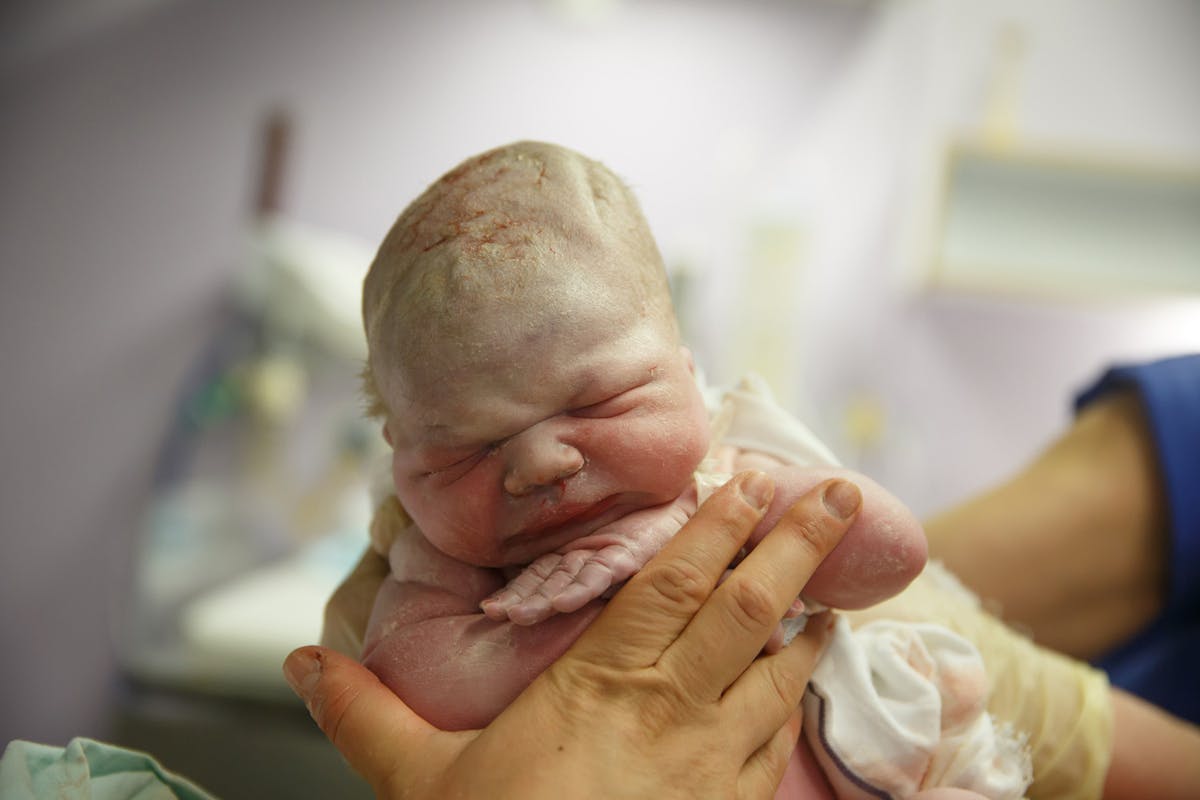 Vernix Caseosa: Wash It Off Baby After Birth or Rub It In?