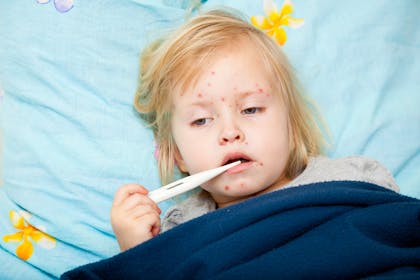 sick girl with rash on face and thermometer in mouth