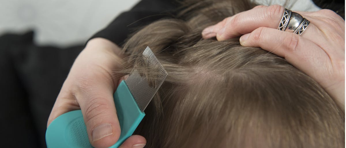 Warning these popular head lice products can catch fire Netmums Reviews