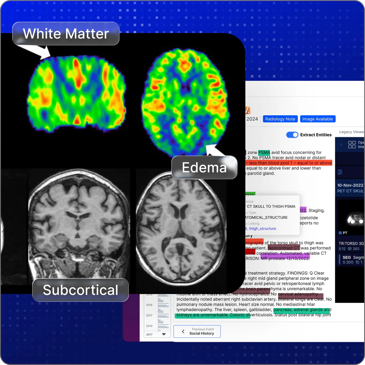 Reveal research signals hidden in notes and images.png