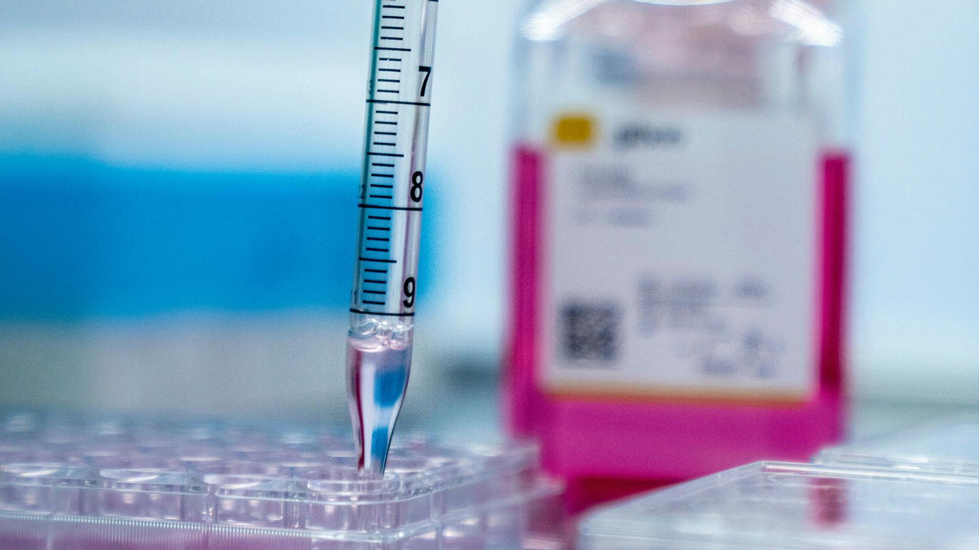 Researchers in Cambridge already work on a potential sickle cell gene therapy.