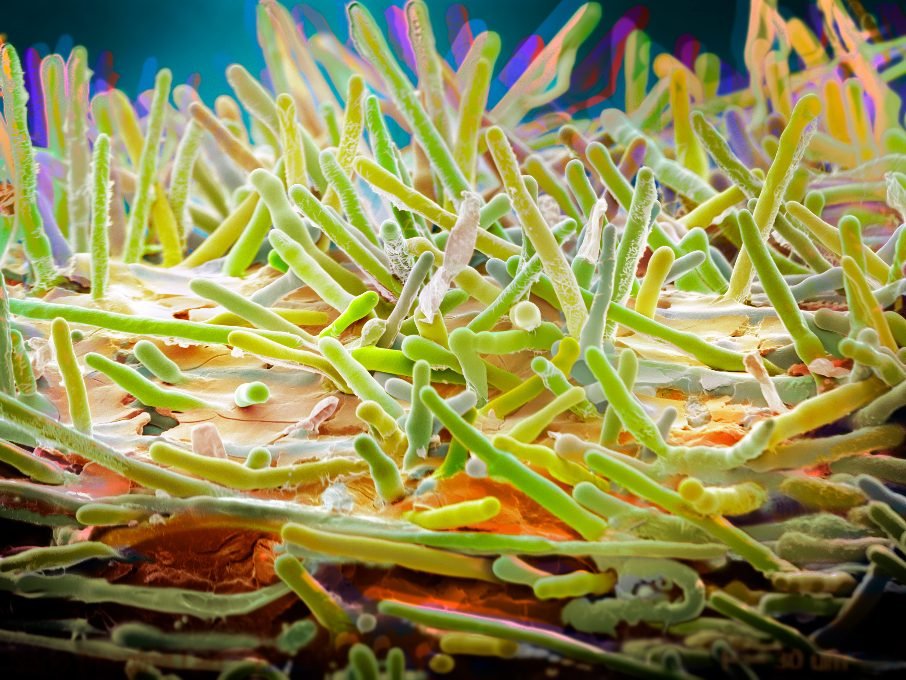 Ergot-Pilz im Mikroskop – mikroskopische Aufnahme für Forschung und Medizin.