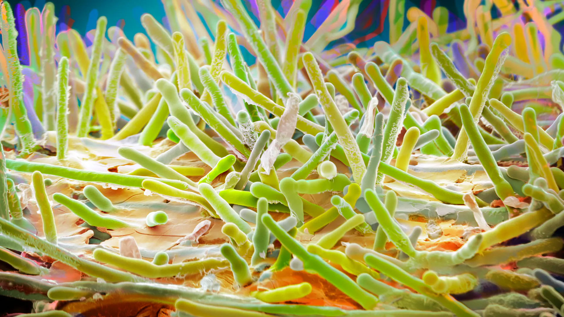 Ergot-Pilz im Mikroskop – mikroskopische Aufnahme für Forschung und Medizin.