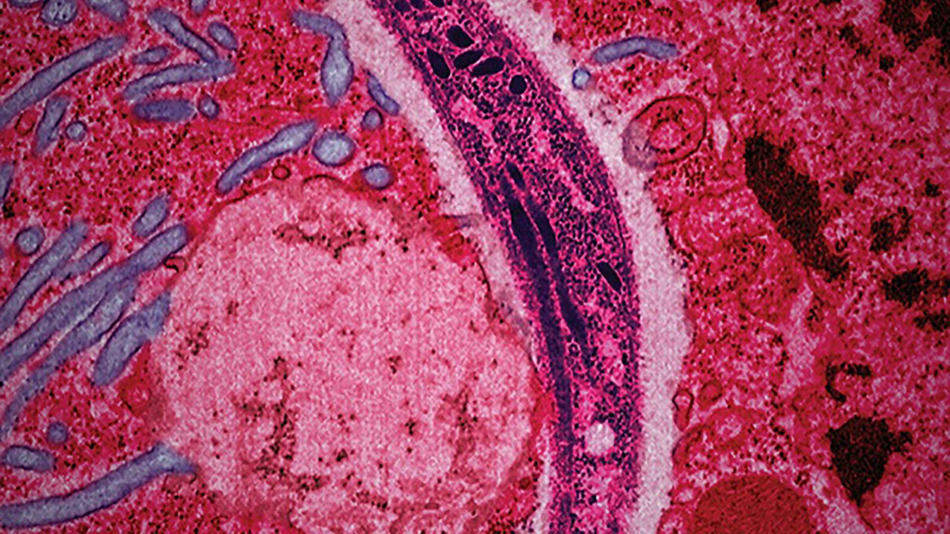 Mikroskopische Aufnahme des Malaria-Parasiten.