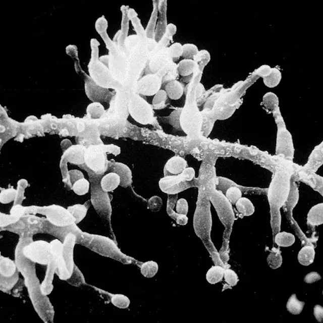 Microscopic photograph of the mold Tolypocladium inflatum (active ingredient: Cyclosporine), which was isolated by Sandoz in the 1970s from a soil sample brought back from Norway. Cyclosporine is the basis for Sandimmune, a medication used to fight organ rejection following transplantation.