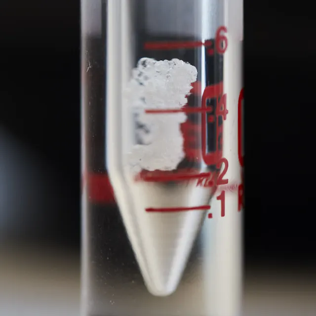 Lynn Hershman’s antibody has no medical use. But its existence has brought science and... 