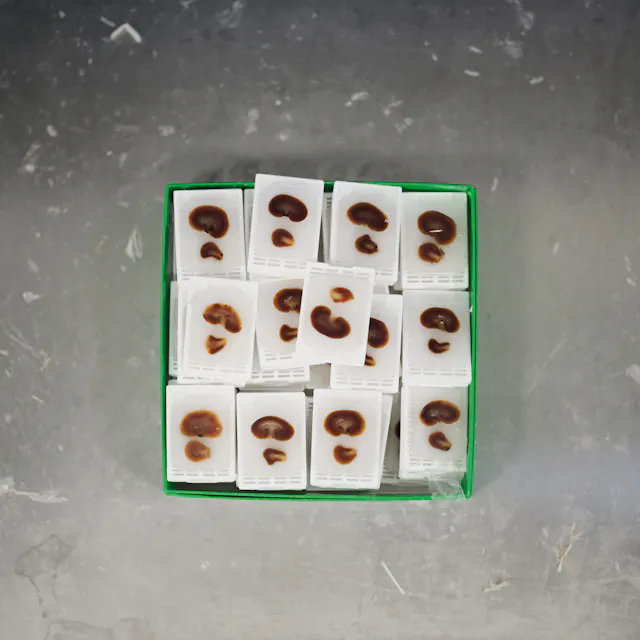 Classic pathology samples before they are readied to be cut in thin slices and digitized.