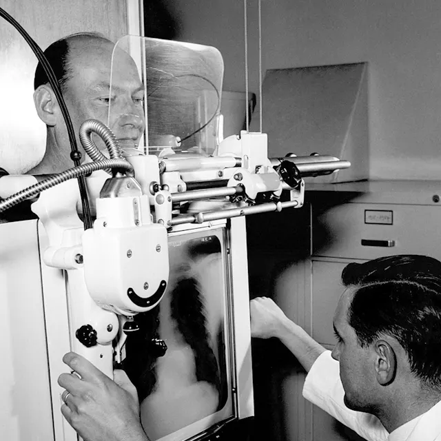 Screening examinations such as this one at CIBA in the 1950s primarily served to detect early signs of tuberculosis.
