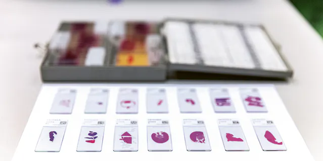 microscope slides used in a laboratory setting, likely for pathology or histology