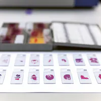 microscope slides used in a laboratory setting, likely for pathology or histology