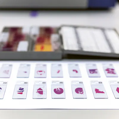 microscope slides used in a laboratory setting, likely for pathology or histology