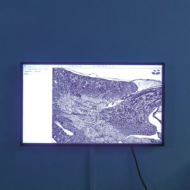 Modern tissue analysis.