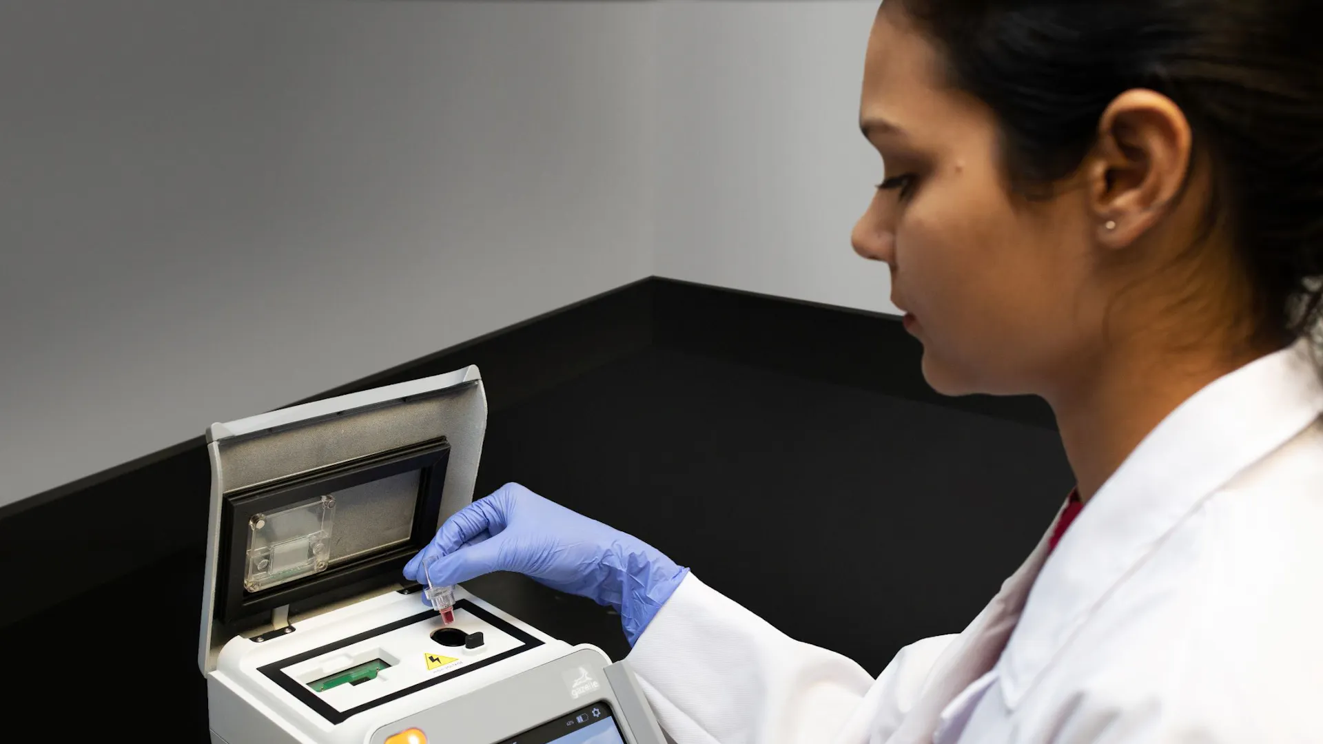 Diagnosing blood from patients potentially suffering from sickle cell disease or malaria