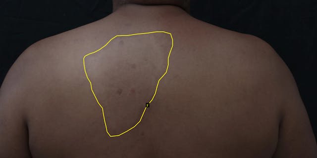 Neueste Technik Im Kampf Gegen Die Alteste Krankheit Der Welt Novartis Live Magazine Neueste Technik Im Kampf Gegen Die Alteste Krankheit Der Welt Novartis Live Magazine