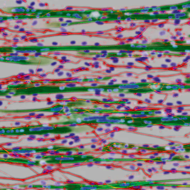 Myotubes (green) cocultured with iPS-derived neurons (red).
