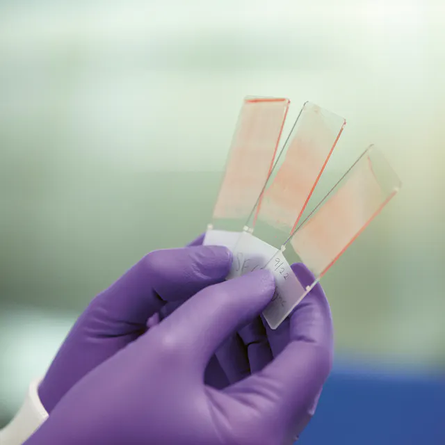 Smear test samples...