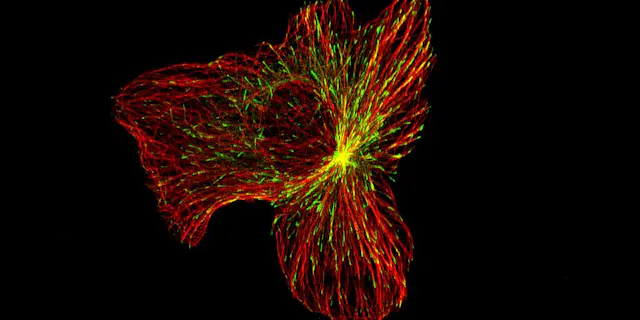The internal structure of a migrating cancer cell