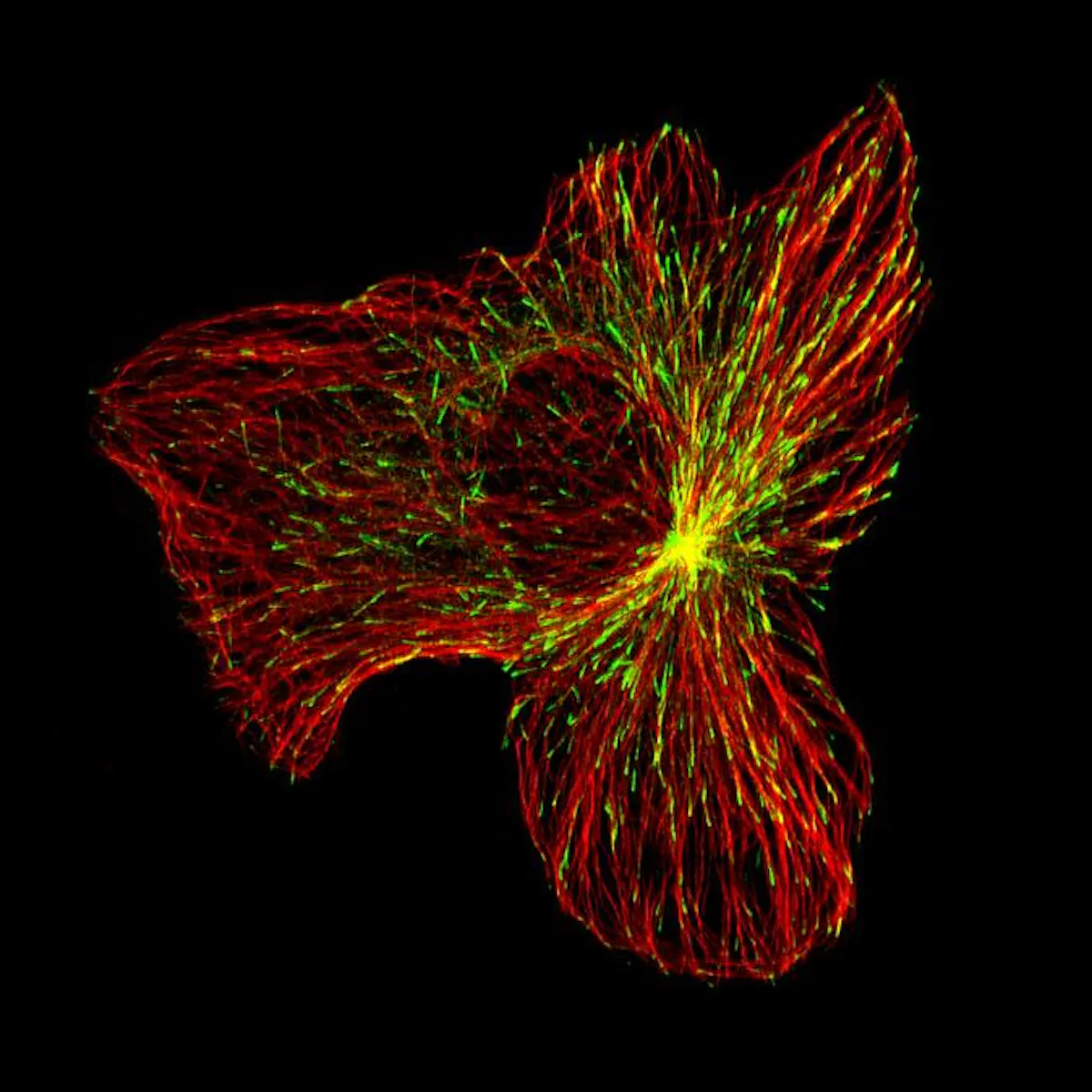 The internal structure of a migrating cancer cell