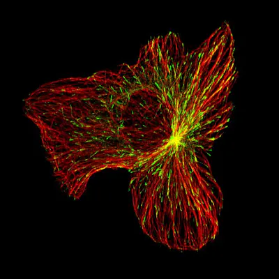 The internal structure of a migrating cancer cell