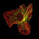 The internal structure of a migrating cancer cell