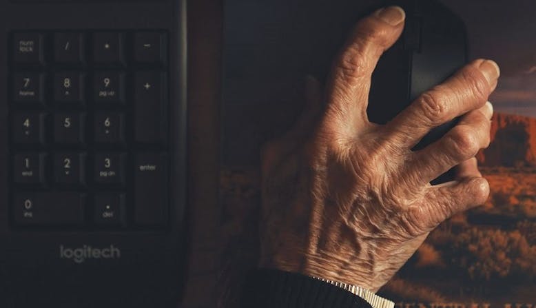 A hand with psoriatic arthritis gripping a mouse next to a computer