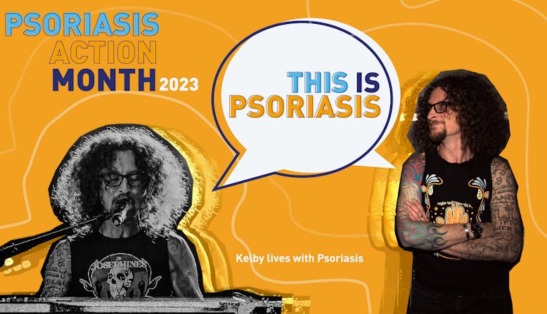 #ThisIsPsoriasis - Psoriasis Action Month 2023 - Kelby lives with Psoriasis