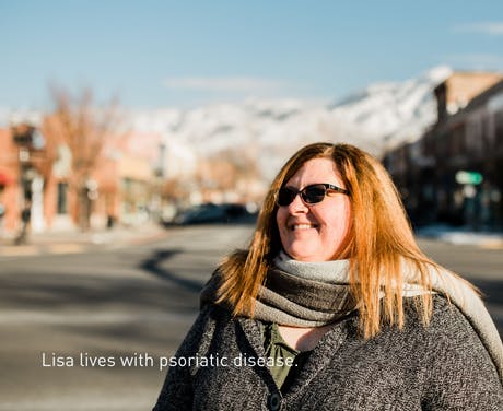 Lisa lives with psoriatic disease.